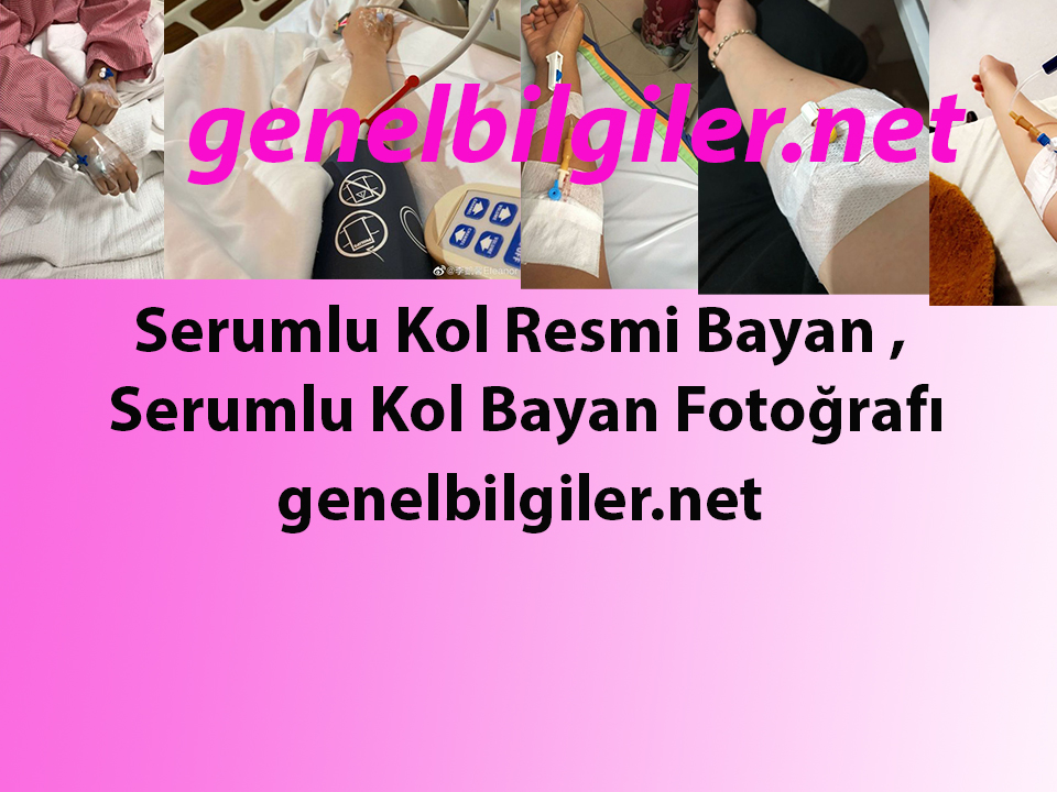 Serumlu Kol Resmi Bayan , Serumlu Kol Bayan